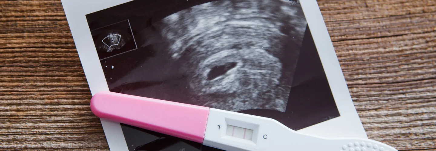 Comprendre les Grossesses Chimiques