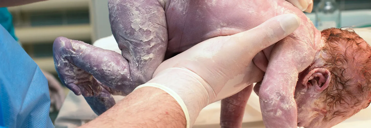 Peut-on accoucher par voie basse après une FIV ?