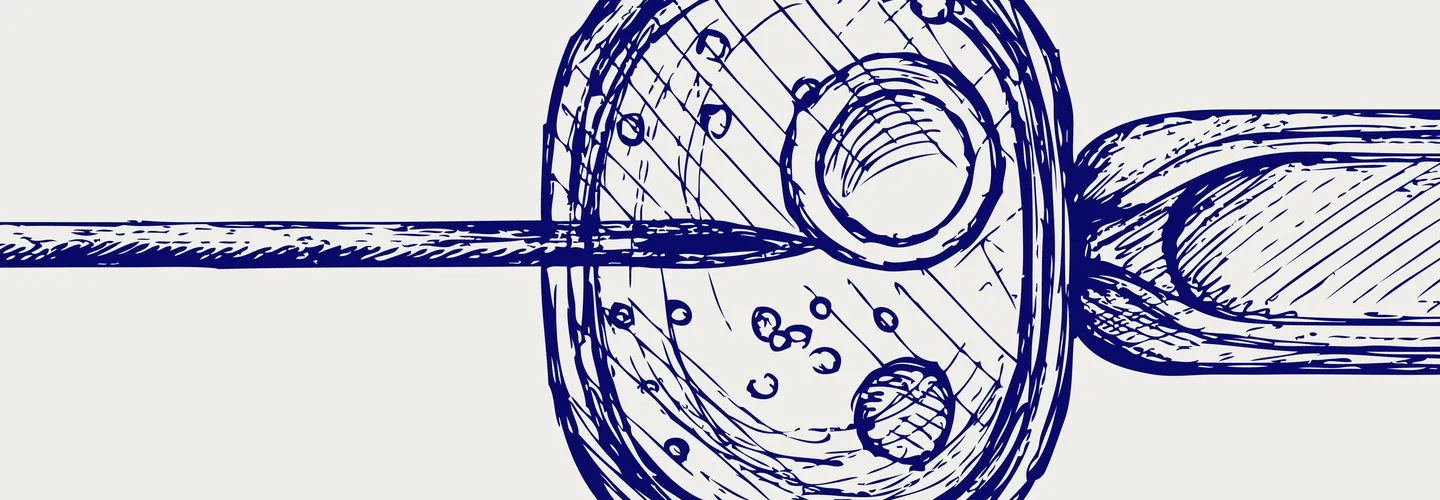 Comprendre l'infertilité féminine dans le contexte des traitements par FIV