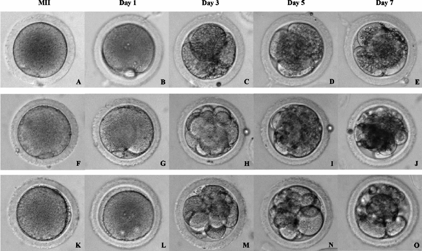 Oositlerin F ve K öncesi ve sonrası görüntüsü